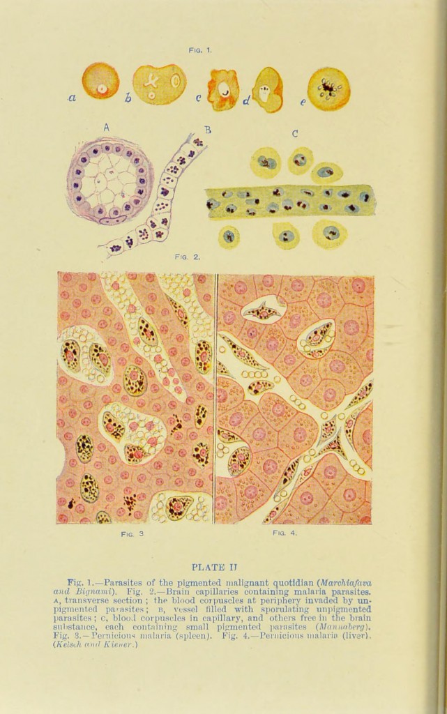 A page from 'Tropical diseases: a manual of the diseases of warm climates' written by Sir Patrick Manson in 1898 - a year before he would found the School.